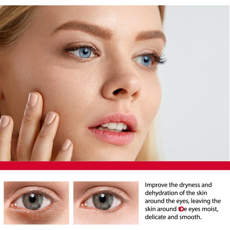 Women Bags Under Eyes - Göz Altı Torbaları ve Morluklar İçin