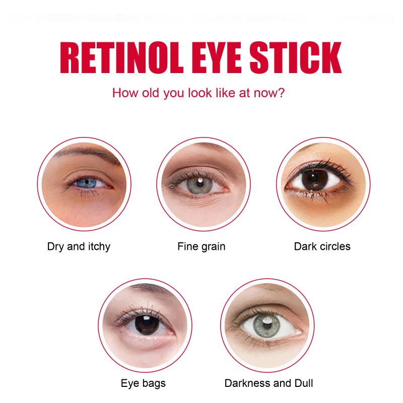 Göz Altı Torbaları ve Morlukla - Women Bags Under Eyes incelemesi ve fiyatı