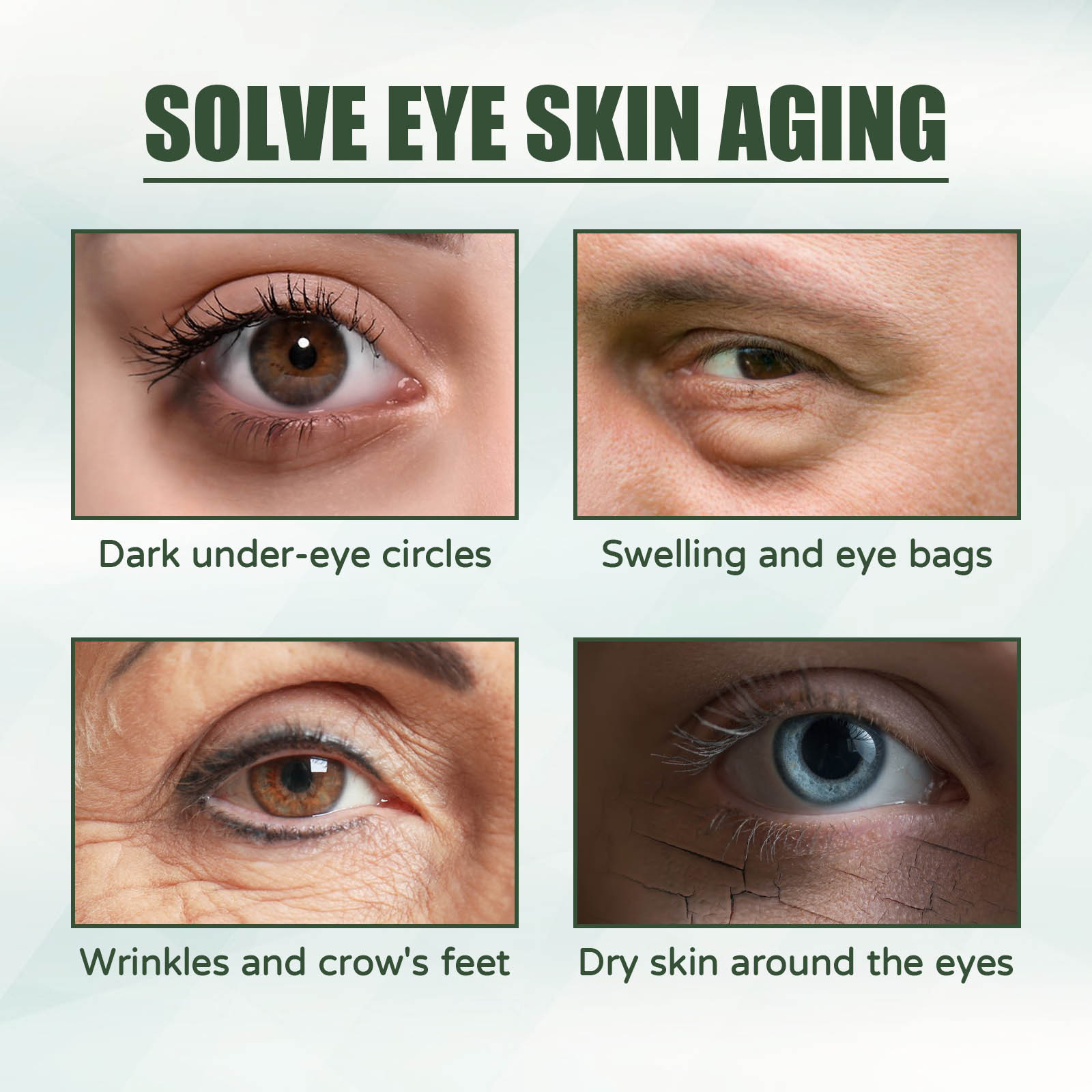 EELHOE Anti Aging göz kremi gö - Women Bags Under Eyes incelemesi ve fiyatı