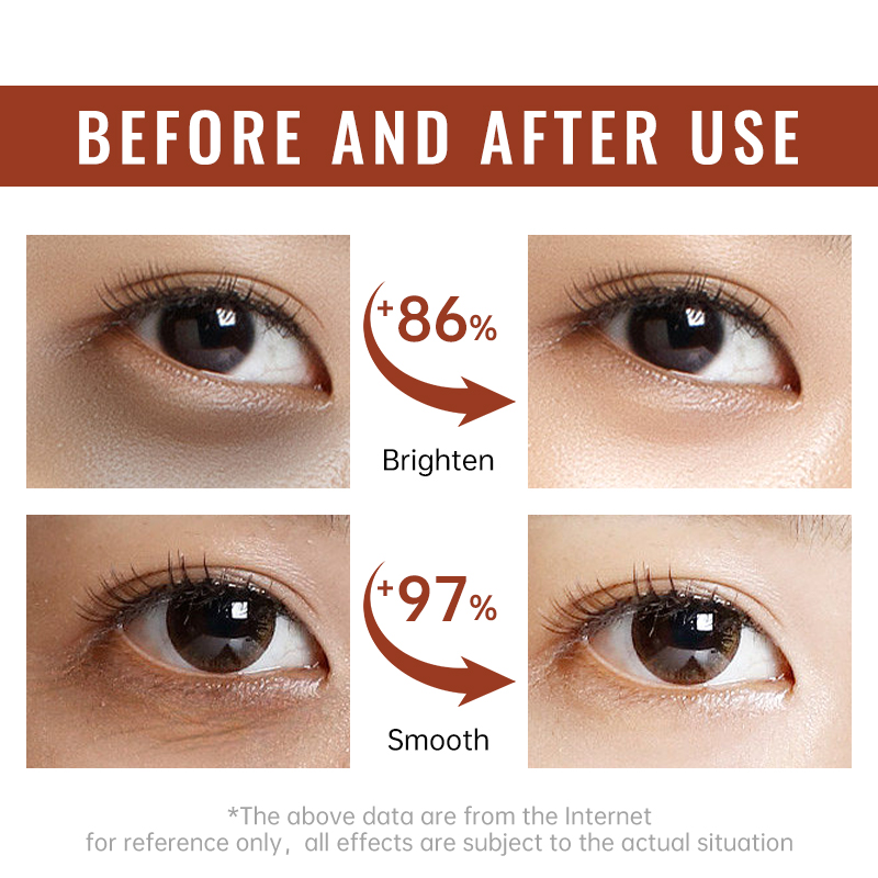 Retinol Sıkılaştırıcı Göz Krem - Women Bags Under Eyes incelemesi ve fiyatı